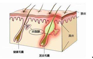 毛囊长进毛发视频,揭秘毛囊与毛发生长的神奇之旅
